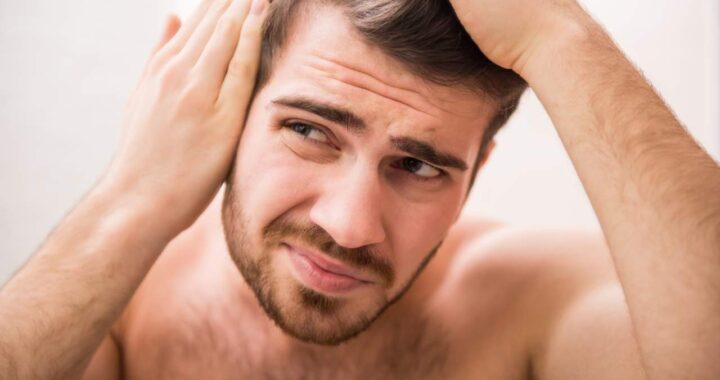 Un 42% de hombres en España son calvos, ¿cómo retrasar ese efecto? Método DHI por Dr. Bern Barbehito