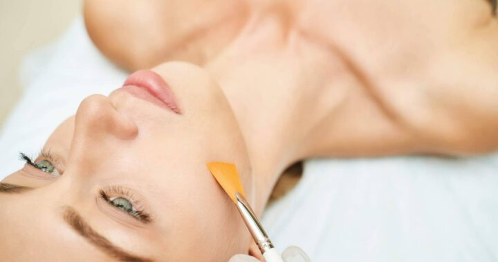 Peeling médico, el tratamiento disponible en Unidad Femme que consigue mejorar la salud y el aspecto de la piel