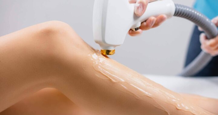 Dermativa sobre las zonas que más se depilan las mujeres con láser y por qué