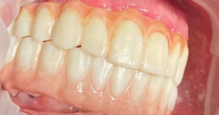 Dentinova aplica la impresión 3D para hacer posible los dientes en un día